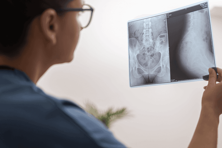 SITE_Exames por imagem-X.png